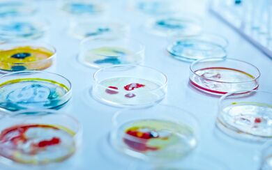 Petri dishes with bacteria samples and pipette drops with liquid solution in a microbiology laboratory